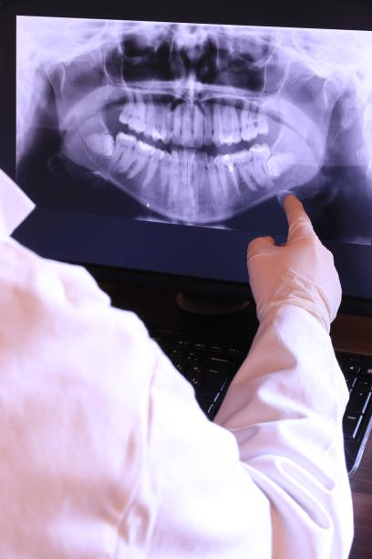 Best Emergency Tooth Extraction in Grinnell, IA